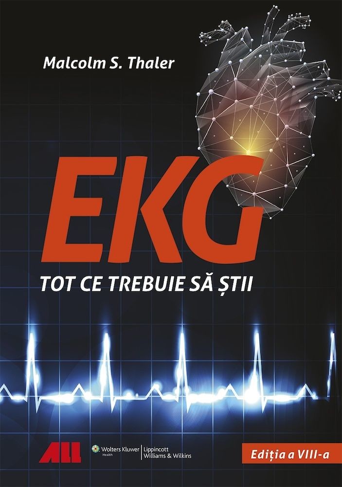 EKG - Tot ce trebuie sa stii PDF